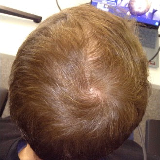 After